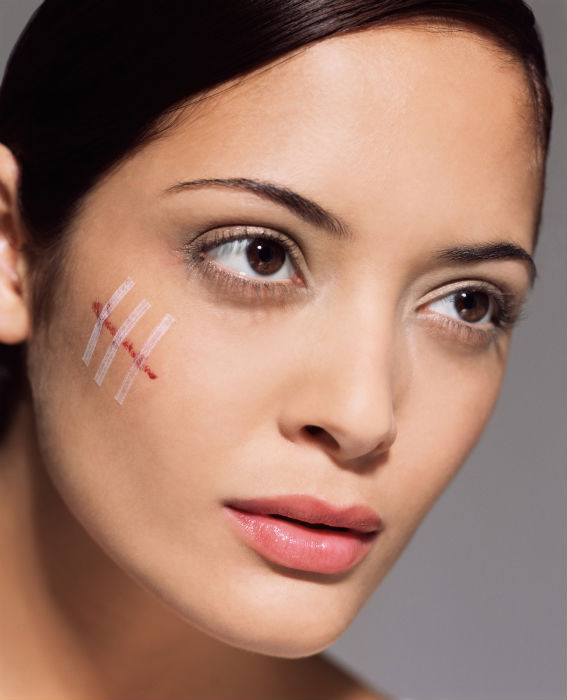 Cum să scapi de cicatricile acneei: lasere și alte tipuri de tratamente