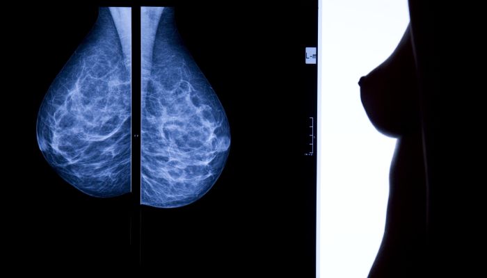 mamografie neurorad