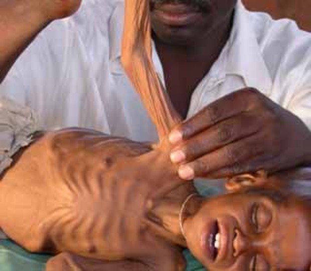 Oficial E Foamete In Somalia Onu Declara Catastrofa Umanitara In