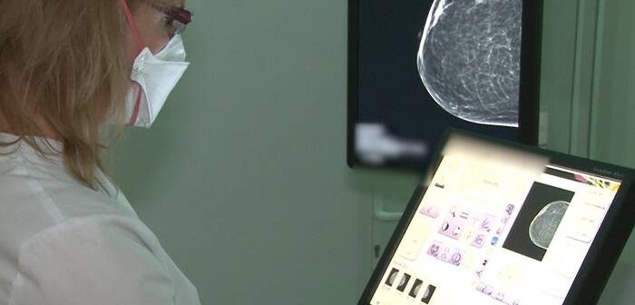 Cat de importanta e mamografia in depistarea cancerului, cum si cand trebuie facuta. Explicatiile medicilor de la Spitalul Victor Babes din Timisoara